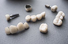 Different types of dental implants in Torrington on gray background