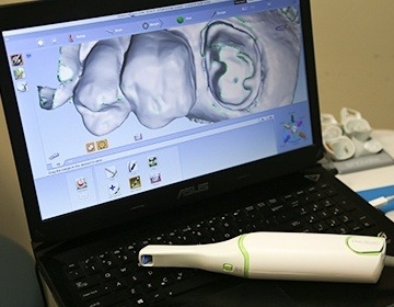 Digital bite impression on computer in Torrington dental office