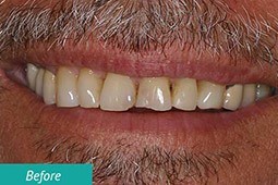 David's smile before treatment