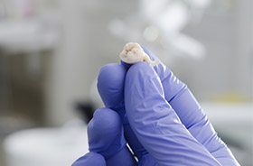 Hand holding an extracted tooth