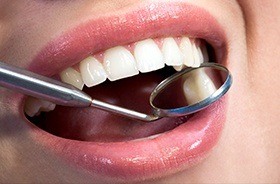 Closeup of smile during dental exam