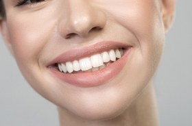 Woman’s beautiful, straight teeth after orthodontics in Torrington