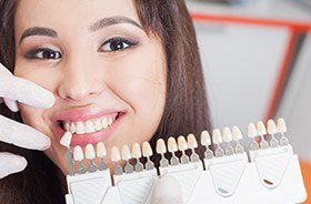 Patient's smile compared with tooth color chart