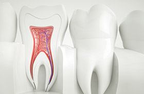 Animation of the inside of the tooth