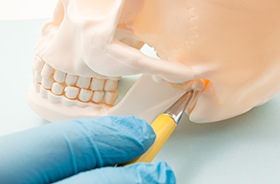 Pen pointing at temporomandibular joint in model