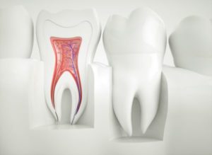 Cross-section of tooth, showing pulp and root canal in Torrington