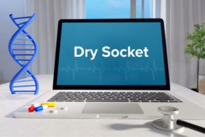 “Dry socket” written on laptop screen