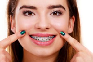 Young woman wearing orthodontic braces