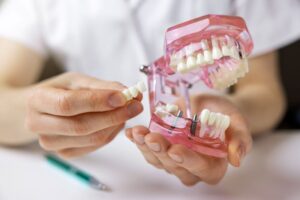 Dentist using model to explain information about dental implants 