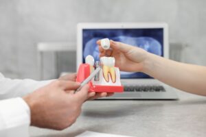 Dentist and patient handling dental implant model
